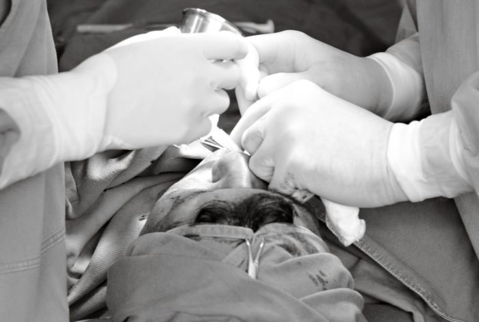 Dr Mohamed Elgaidi svc pain