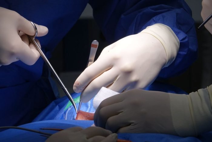 Dr Mohamed Elgaidi svc spine